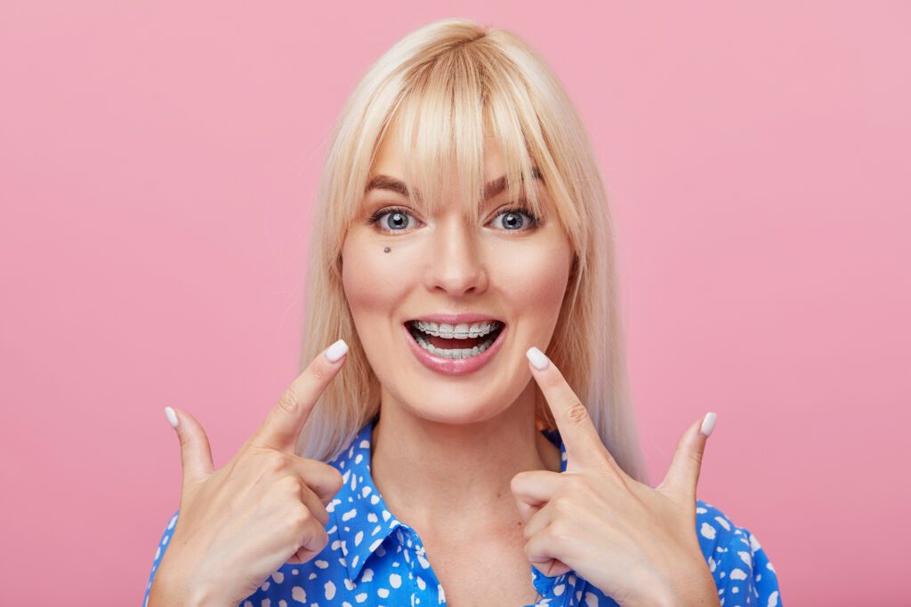 The Ultimate Guide to Ceramic Braces: 4 Benefits for a Confident Smile - MyOrthodontist - affordable orthodontist,affordable Invisalign types of braces, ceramic braces